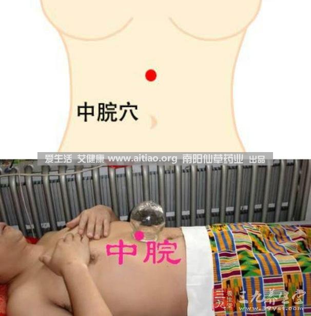 中脘穴位于腹部正中線(xiàn)，臍上4寸的位置上。每天艾灸10-15分鐘，能有效緩解胃部不適的癥狀，同時(shí)有助于祛濕。